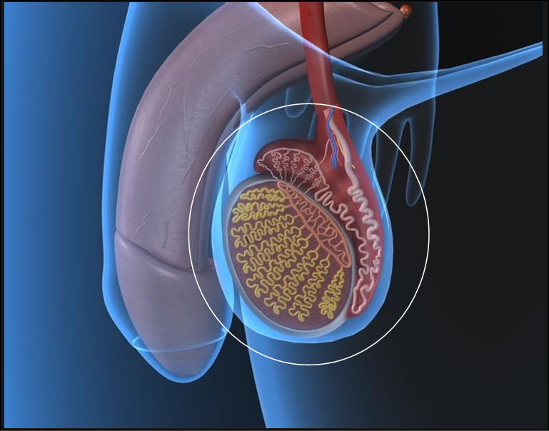 cancer-de-testiculo